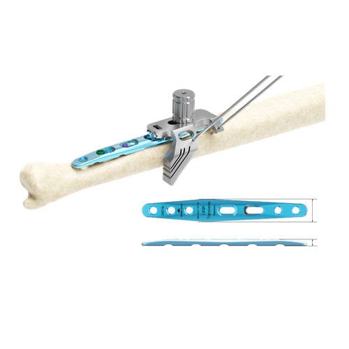 Ulna osteotomy plate - ARIX 2.8 - Jeil Medical Corporation - mid-shaft / locking / titanium
