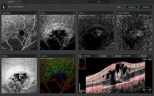 Measurement software module - Optopol Technology - visualization / evaluation / diagnostic