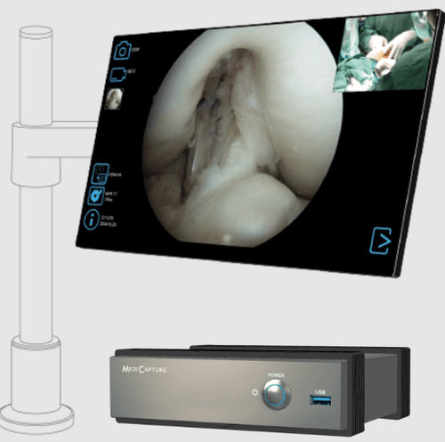 Surgical video recorder - MVR 4K  - MediCapture - medical / 4K / compact