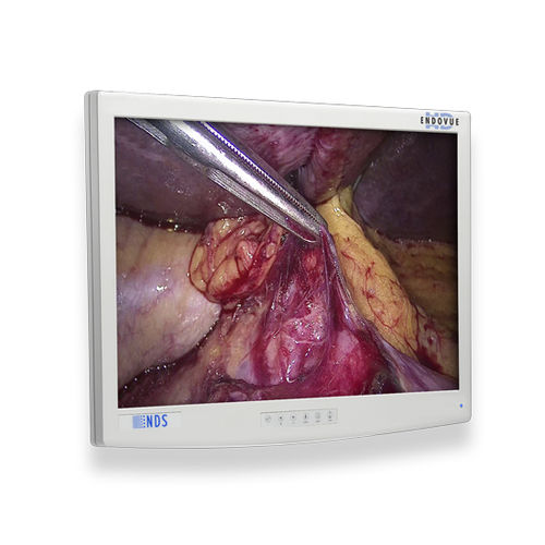 Medical monitor - EndoVue®  - NDS Surgical Imaging - medical imaging / endoscopy / surgical