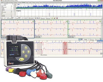 Analysis software - NH-301 - NORAV Medical - diagnostic / monitoring / recording