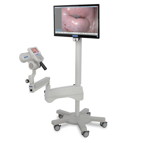 Digital colposcope - ColpoScreen - OPTOMIC - video