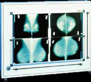 2-screen X-ray film viewer - DXHM 72 x 46 - PrimaX Berlin - with switch / for mammography / with shutter