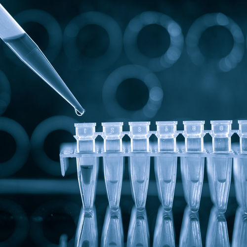 Sexually transmitted disease test kit - QP10705 - Randox Laboratories - herpes simplex virus / Treponema pallidum / urine