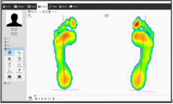 Analysis software - v9 Essentials - Materialise - measurement / sharing / for orthopedic insole design