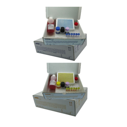Serum reagent kit FLC Sebia clinical / laboratory / blood sample