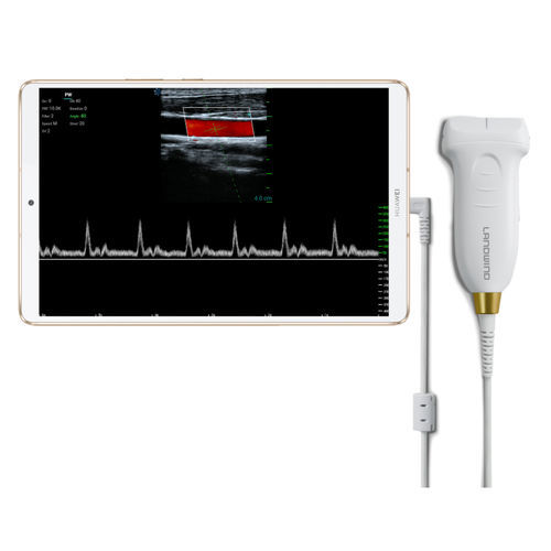 Hand-held ultrasound system - Umagic S - Landwind Medical - for multipurpose ultrasound imaging / B/W / color doppler