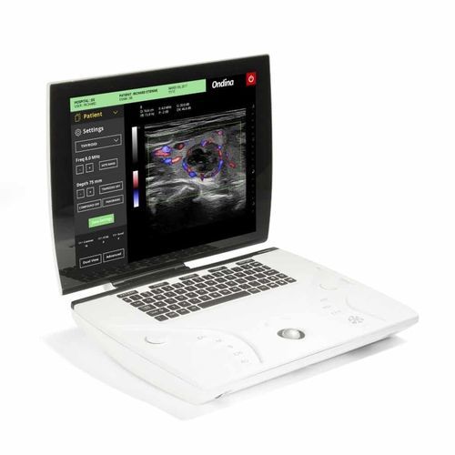Portable ultrasound system - Ondina - Sonoscanner - for gynecological and obstetric ultrasound imaging / for multipurpose ultrasound imaging / for cardiovascular ultrasound imaging