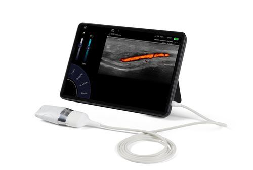 Linear-array ultrasound transducer - Sonoscanner - musculoskeletal / small parts / vascular