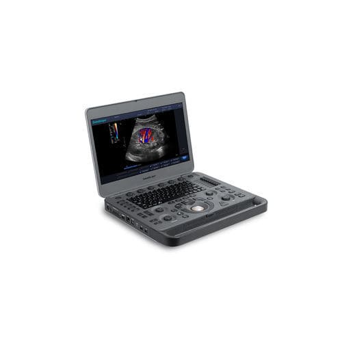 Portable ultrasound system - X3 - SonoScape - for multipurpose ultrasound imaging / B/W / color doppler