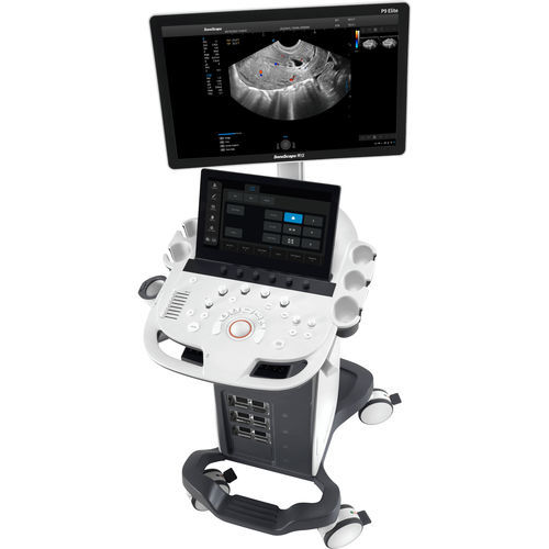 Onplatform, compact ultrasound system P9 Elite SonoScape for
