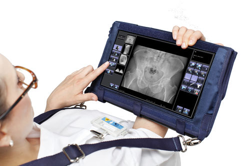 Radiography acquisition system - Nomad DReam - Stephanix - portable