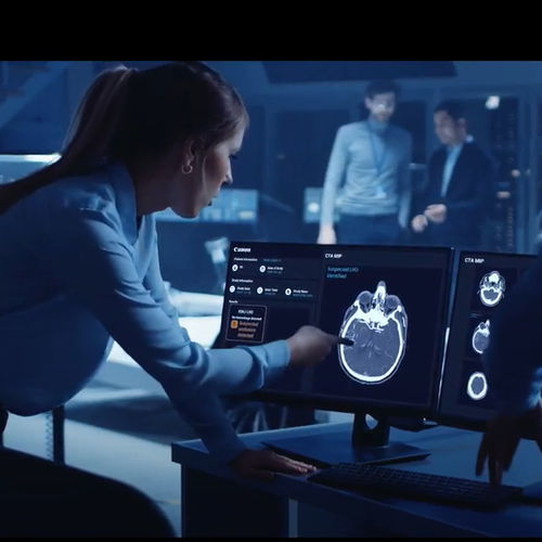Analysis software - Canon Medical Systems Europe - treatment / sharing / clinical