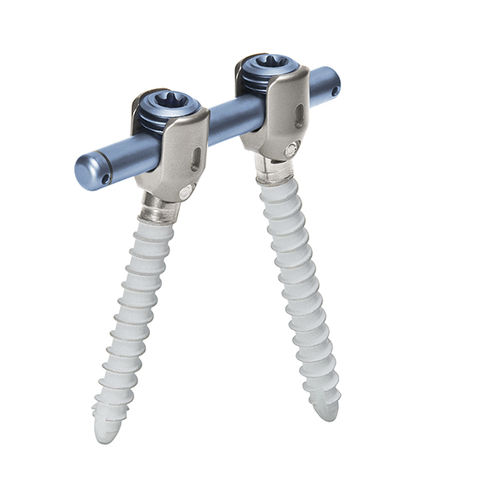 Thoraco-lumbo-sacral osteosynthesis unit - cosmicMIA™ - ulrich medical - posterior / adult