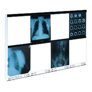 8-screen X-ray film viewer - NGP-80 hf - Ultra-Viol - with switch / white light