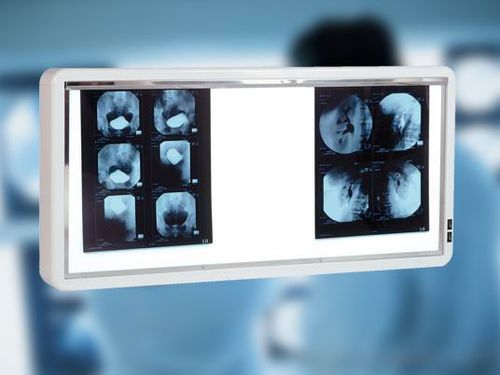 3-screen X-ray film viewer - ENNEA008 - Verre et Quartz Technologies - white light