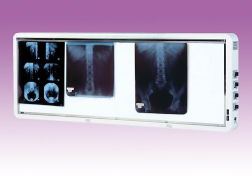 4-screen X-ray film viewer - ENNEA014 - Verre et Quartz Technologies - white light / vertical