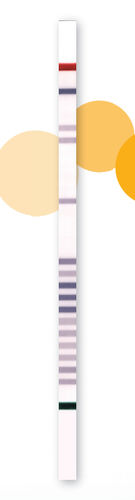 CAH test strip - StripAssay® - ViennaLab Diagnostics  - genetic / blood / DNA analysis