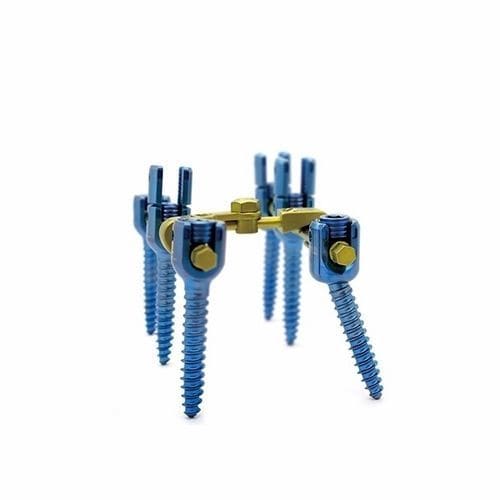 Thoraco-lumbo-sacral osteosynthesis unit - Double Medical Technology - posterior / adult