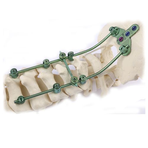 Occipito-cervical osteosynthesis unit - Double Medical Technology - posterior / adult