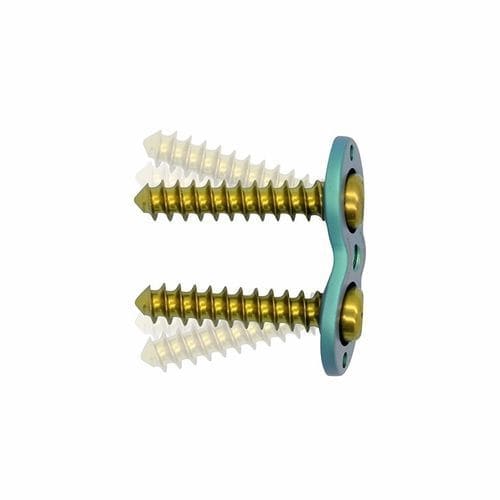 Epiphysis compression plate - Double Medical Technology - ankle / locking / metallic