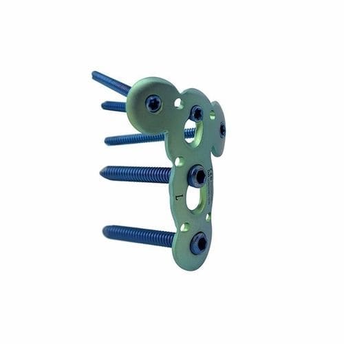 Humerus compression plate - Double Medical Technology - proximal / locking / metallic