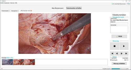Analysis software - DiVAS  - XION medical - visualization / medical / for endoscopy