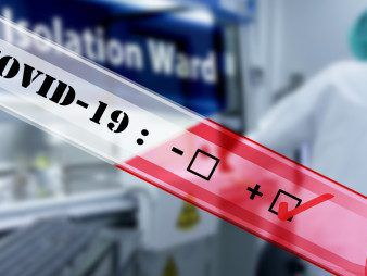 COVID-19 rapid test - Ambisea Technology - for antibodies / IgG / IgM