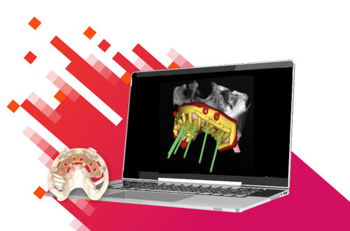 Data management software - Stackable - Carestream Dental - telecollaboration management / design / planning