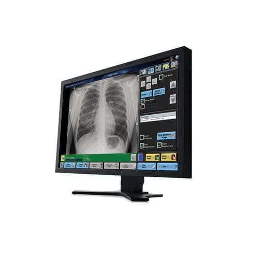 Medical imaging software DIRECTVIEW Carestream visualization