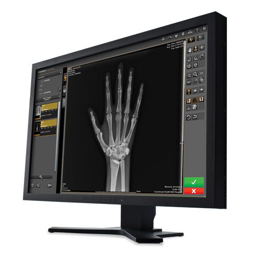 Analysis software - Image Suite V4 - Carestream - management / visualization / acquisition