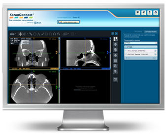 Medical imaging software - XoranConnect® - Xoran - medical ...