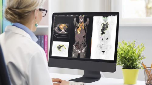 Treatment software - MIM™ - GE Healthcare - planning / treatment planning / medical