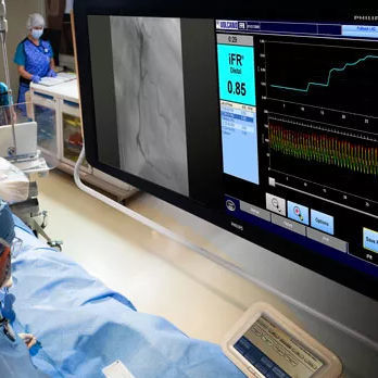 Cardiovascular display - FlexVision XL - Philips Healthcare - high-definition / 58" / LCD