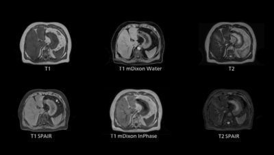 Simulation software - 4D MR-RT - Philips Healthcare - contouring / treatment planning / medical