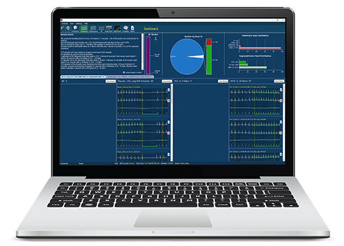 Screening software - Lifescreen Pro - Spacelabs Healthcare - analysis / diagnostic / recording