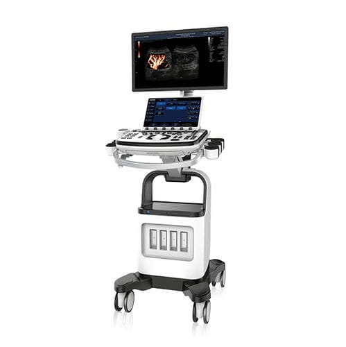 on-platform ultrasound system - CHISON Medical Technologies