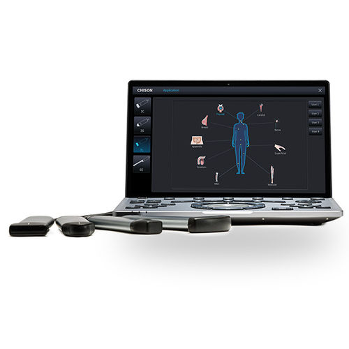 portable ultrasound system - CHISON Medical Technologies