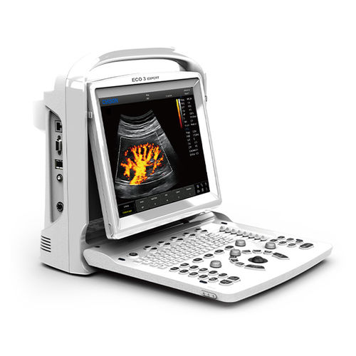 Portable ultrasound system - ECO 3 Expert - CHISON Medical Technologies - for multipurpose ultrasound imaging / color doppler / B/W