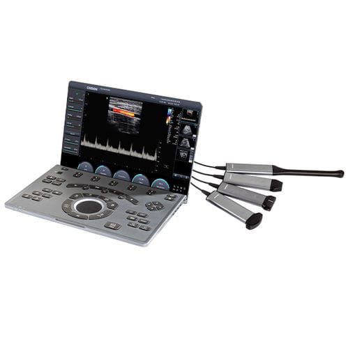 Portable ultrasound system - SonoAir 30 - CHISON Medical Technologies - for multipurpose ultrasound imaging / for gynecological and obstetric ultrasound imaging / for cardiovascular ultrasound imaging