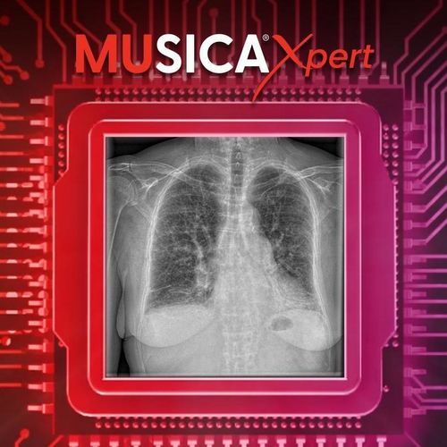 Medical post-processing system - MUSICA Xpert™ - AGFA