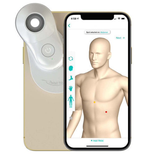 Digital dermatoscope - MoleScope II (Universal) - Dino-Lite Europe - white LED / smartphone-based
