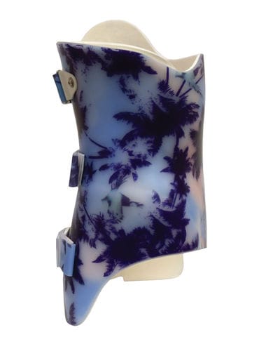 Scoliosis spinal orthosis -  3D SCT Boston (Style) Full-Time - Spinal Technology