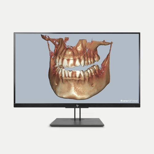 DICOM viewing software module - Ceramill Dicom-Viewer - Amann Girrbach - diagnostic / for control / CAD