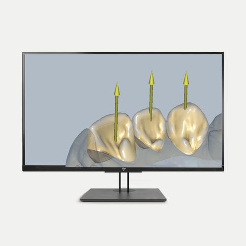 CAD software module - Ceramill Microshell - Amann Girrbach - for dental prosthesis design / treatment / dental