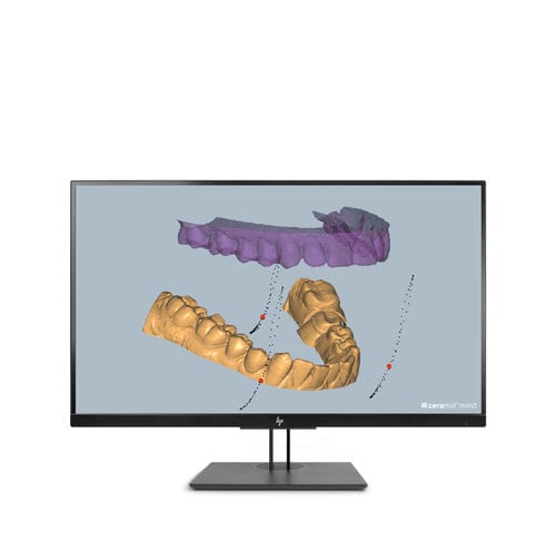 CAD software module - Ceramill M-Pass - Amann Girrbach - import / for dental implantology / joint