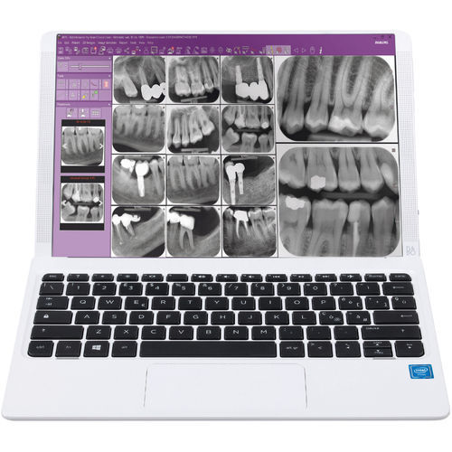 Control software - iRYS - Anthos   - viewer / diagnostic / recording