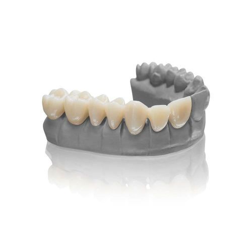 Resin dental material - VarseoSmile&reg; Temp - BEGO - for dental onlays / for 3D printing / for dental veneers