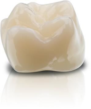 Hybrid dental material - VarseoSmile&reg; Crown plus - BEGO - hybrid-ceramic / resin / for dental crowns