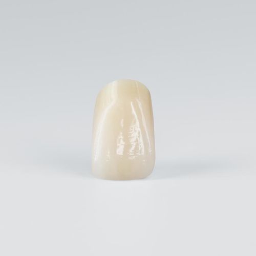 PMMA dental prosthesis - PhysioSelect TCR  - Candulor - resin / lower incisor / upper incisor